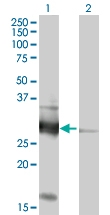 H00009217-B01P - VAMP-associated protein B/C (VAPB)