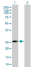 H00009217-B02P - VAMP-associated protein B/C (VAPB)