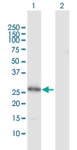 H00009217-D01 - VAMP-associated protein B/C (VAPB)