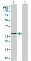 H00009217-D01P - VAMP-associated protein B/C (VAPB)