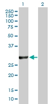 H00009217-D03P - VAMP-associated protein B/C (VAPB)