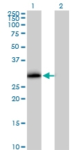 H00009218-B01P - VAMP-associated protein A (VAPA)