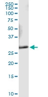 H00009218-D01 - VAMP-associated protein A (VAPA)