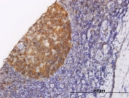 H00009221-M02 - NOLC1