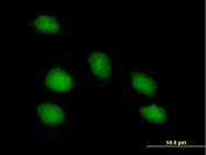 H00009240-B01P - PNMA1 / MA1