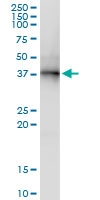 H00009240-D01 - PNMA1 / MA1