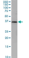 H00009240-M02 - PNMA1 / MA1