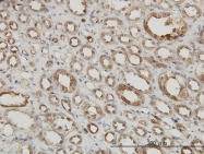 H00009261-M01 - MAPKAP Kinase-2