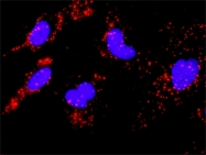 H00009261-M01 - MAPKAP Kinase-2