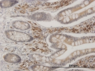 H00009261-M08 - MAPKAP Kinase-2