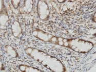 H00009266-M02 - Cytohesin 2