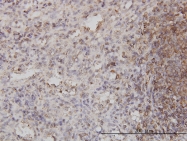 H00009267-M01 - Cytohesin 1
