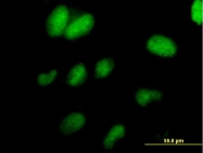 H00009338-B01 - TCEAL1 / SIIR