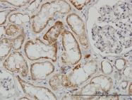 H00009344-M03 - TAO kinase 2 (TAOK2)