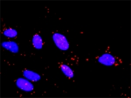 H00009344-M11 - TAO kinase 2 (TAOK2)