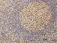 H00009412-M08 - MED21