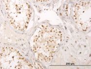 H00009440-M01 - MED17