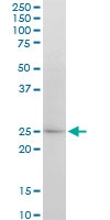 H00009474-M04 - APG5L / ATG5