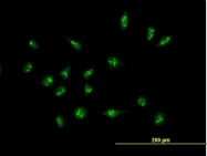 H00009502-B01P - XAGE2 / G antigen family D member 3