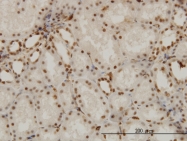 H00009572-M02 - NR1D1