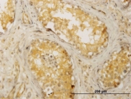 H00009578-M02 - CDC42BPB