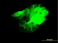 H00009578-M03 - CDC42BPB