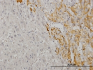 H00009586-M02 - CREB5