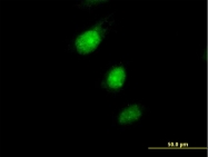 H00009587-B01P - MAD2L1-binding protein