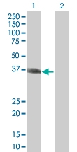 H00009587-B02P - MAD2L1-binding protein