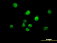 H00009587-B02P - MAD2L1-binding protein