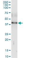 H00009587-D01 - MAD2L1-binding protein