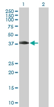 H00009587-D01P - MAD2L1-binding protein
