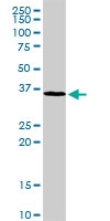 H00009587-D01P - MAD2L1-binding protein