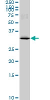 H00009587-M03 - MAD2L1-binding protein