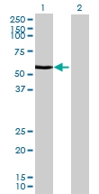 H00009589-B01 - WT1 / Wilms tumor protein
