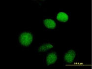 H00009589-B01 - WT1 / Wilms tumor protein