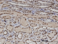 H00009589-M01 - WT1 / Wilms tumor protein
