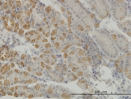 H00009625-M01 - LMTK1 / AATK