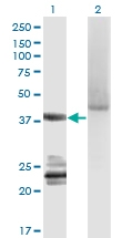 H00009630-M06 - G protein alpha 14