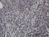 H00009641-M04 - IKBKE / IKKE
