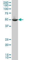 H00009647-A01 - Protein phosphatase 1F / PPM1F