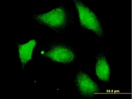 H00009647-B01P - Protein phosphatase 1F / PPM1F