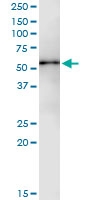 H00009647-D01 - Protein phosphatase 1F / PPM1F