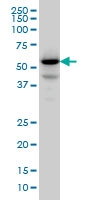 H00009647-M01 - Protein phosphatase 1F / PPM1F