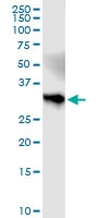 H00009653-D01 - HS2ST1 / 2OST