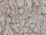H00009655-M01 - SOCS5 / CIS6