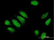 H00009659-B01P - Myomegalin