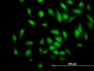 H00009659-M01 - PDE4D