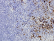 H00009709-M04 - HERPUD1