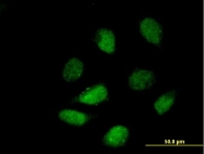 H00009734-B01P - HDAC9